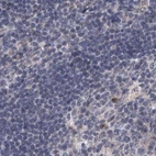 Immunohistochemical staining of human lymph node using Anti-DBT antibody HPA026533.