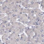 Anti-DBT Antibody