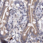 Immunohistochemical staining of human colon using Anti-DBT antibody HPA026533.