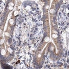 Immunohistochemical staining of human colon using Anti-DBT antibody HPA026533.