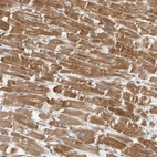 Immunohistochemical staining of human heart muscle shows moderate cytoplasmic positivity in cardiomyocytes.