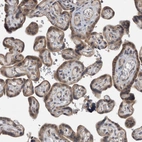 Immunohistochemical staining of human placenta shows moderate cytoplasmic positivity in trophoblastic cells.