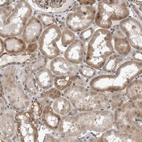 Immunohistochemical staining of human kidney shows moderate cytoplasmic positivity in cells in tubules.
