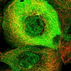 Immunofluorescent staining of human cell line A-431 shows localization to nucleoplasm, plasma membrane & centrosome.