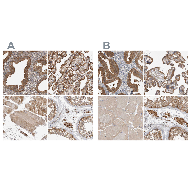 Anti-KYAT3 Antibody