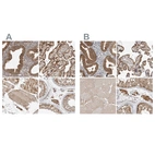 Anti-KYAT3 Antibody
