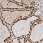 Immunohistochemical staining of human thyroid gland shows strong granular cytoplasm positivity in glandular cells.
