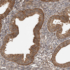 Immunohistochemical staining of human endometrium shows strong granular cytoplasm positivity in glandular cells.
