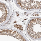 Immunohistochemical staining of human testis shows strong granular cytoplasm positivity in Leydig cells and cells in seminiferous ducts.