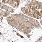 Immunohistochemical staining of human skeletal muscle shows moderate granular cytoplasm positivity in myocytes.