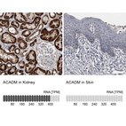 Anti-ACADM Antibody