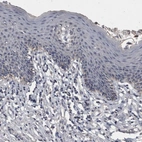Immunohistochemical staining of human skin shows no positivity in squamous epithelial cells as expected.