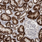 Immunohistochemical staining of human kidney shows strong granular cytoplasmic positivity in cells in tubules.