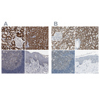 Immunohistochemical staining of human kidney, liver, lymph node and skin using Anti-ACADM antibody HPA026542 (A) shows similar protein distribution across tissues to independent antibody HPA006198 (B).