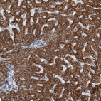 Anti-ACADM Antibody