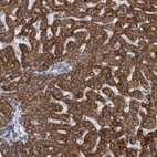 Immunohistochemical staining of human liver shows strong to very strong positivity in cytoplasm granular in hepatocytes.