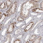 Anti-STRADB Antibody