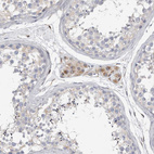 Immunohistochemical staining of human testis shows moderate to strong cytoplasmic positivity in Leydig cells.