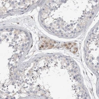 Immunohistochemical staining of human testis shows moderate to strong cytoplasmic positivity in Leydig cells.