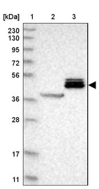 Lane 1: Marker [kDa] 230, 130, 95, 72, 56, 36, 28, 17, 11_br/_Lane 2: Human cell line RT-4_br/_Lane 3: Human cell line U-251MG sp