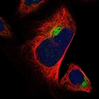 Immunofluorescent staining of human cell line U-2 OS shows localization to cytosol & aggresome.