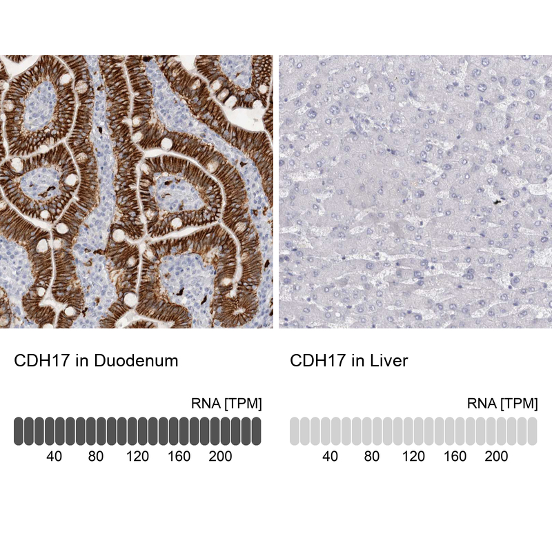 Anti-CDH17 Antibody