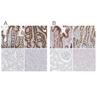 Immunohistochemical staining of human colon, duodenum, kidney and liver using Anti-CDH17 antibody HPA026556 (A) shows similar protein distribution across tissues to independent antibody HPA023614 (B).