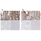Immunohistochemical staining of human colon, duodenum, kidney and liver using Anti-CDH17 antibody HPA026556 (A) shows similar protein distribution across tissues to independent antibody HPA023614 (B).