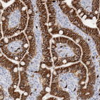 Immunohistochemical staining of human duodenum shows strong membranous positivity in glandular cells.