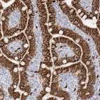 Immunohistochemical staining of human duodenum shows strong membranous positivity in glandular cells.