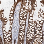 Immunohistochemical staining of human colon shows strong membranous positivity in glandular cells.