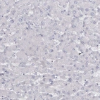 Immunohistochemical staining of human liver shows no positivity in hepatocytes as expected.