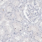 Immunohistochemical staining of human kidney shows no positivity in cells in tubules as expected.