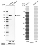 Western blot analysis in human cell lines Caco-2 and SK-MEL-30 using Anti-CDH17 antibody. Corresponding CDH17 RNA-seq data are presented for the same cell lines. Loading control: Anti-HDAC1.