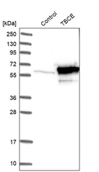 Western blot analysis in control (vector only transfected HEK293T lysate) and TBCE over-expression lysate (Co-expressed with a C-terminal myc-DDK tag (~3.1 kDa) in mammalian HEK293T cells, LY418845).