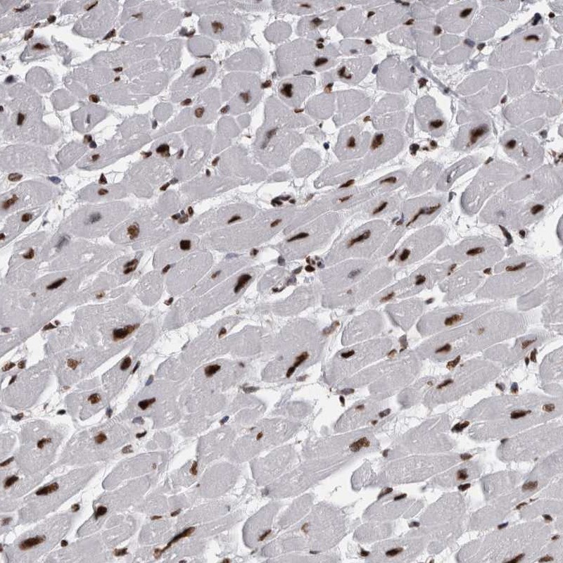 Anti-ALPK3 Antibody