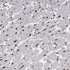 Anti-ALPK3 Antibody