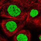 Immunofluorescent staining of human cell line A-431 shows localization to nucleoplasm.