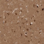 Anti-PITPNC1 Antibody
