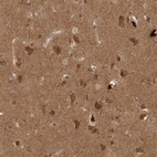 Anti-PITPNC1 Antibody