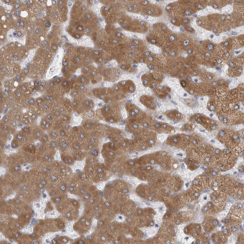 Anti-LRRC40 Antibody