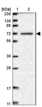 Lane 1: Marker [kDa] 230, 130, 95, 72, 56, 36, 28, 17, 11_br/_Lane 2: Human cell line RT-4