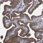Immunohistochemical staining of human fallopian tube shows strong membranous and cytoplasmic positivity in glandular cells.