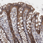 Immunohistochemical staining of human rectum shows moderate membranous and cytoplasmic positivity in glandular cells.