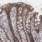 Immunohistochemical staining of human rectum shows moderate membranous and cytoplasmic positivity in glandular cells.