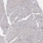 Immunohistochemical staining of human skeletal muscle shows very weak cytoplasmic positivity in myocytes.