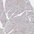 Immunohistochemical staining of human skeletal muscle shows very weak cytoplasmic positivity in myocytes.