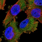 Immunofluorescent staining of human cell line U-251 MG shows localization to cytosol.