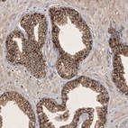 Anti-FAM221B Antibody