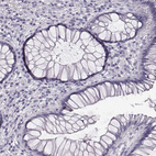 Immunohistochemical staining of human rectum shows no positivity in glandular cells as expected.